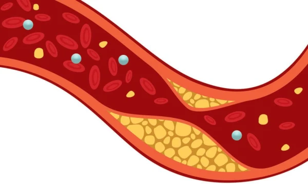 Cholesterol & geslachtshormonen